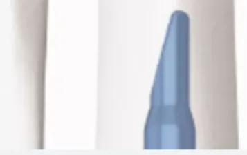 Clavo intramedular tibial distal – fijación retrógrada – imagen 3